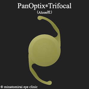 PanOptix Trifocal