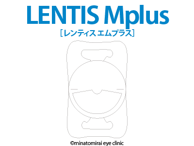 LENTIS® Mplus シリーズ